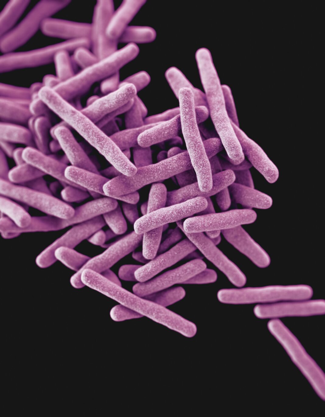 Bacteria studiată este înrudită îndeaproape cu cea responsabilă pentru tuberculoză. Foto: Mycobacterium tuberculosis. Sursă: Unsplash