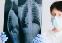 Când aerul se curăță, spitalele încep să se golească. Ce s-a întâmplat după reducerea poluării