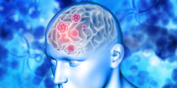 microplastice in creier