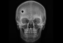 O încercare de sinucidere a dus la vindecarea unei boli psihice imposibile Foto: Facebook/Science Nature Page