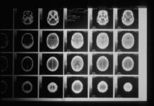 Hărțile cerebrale ale mirosului sunt ordonate, nu haotice — descoperire care rescrie manualele de neuroștiință