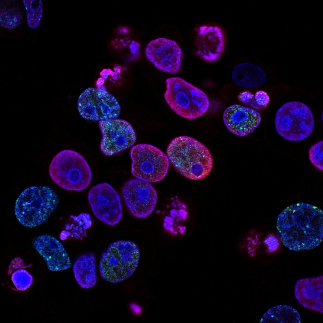 Mielom multiplu - Foto Institutul Național al Cancerului Unsplash